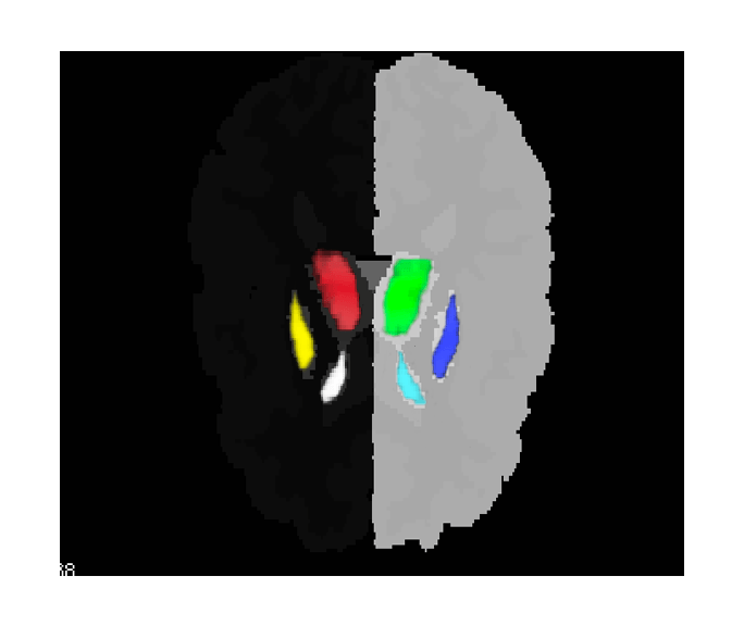 CV Neural Networks